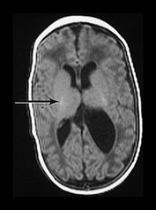 Fig. 9.28 (bii)
