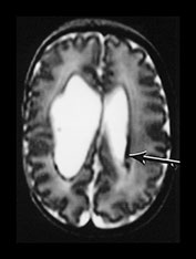 Fig. 9.29 (a)