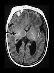 Fig. 9.29 (bi)