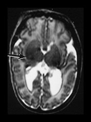 Fig. 9.29 (bii)