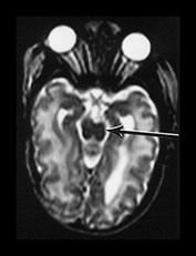 Fig. 9.29 (ci)