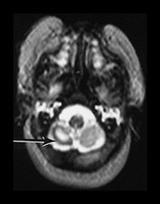 Fig. 9.29 (cii)