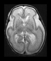 Fig. 9.30 (a)