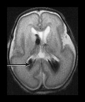 Fig. 9.30 (b)
