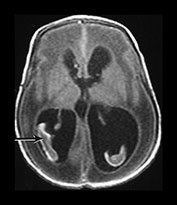 Fig. 9.30 (ci)