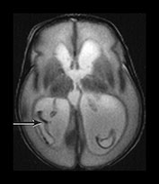 Fig. 9.30 (cii)
