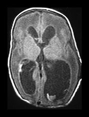 Fig. 9.30 (di)