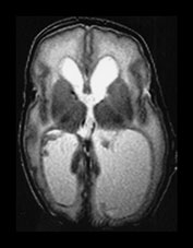 Fig. 9.30 (dii)