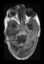 Fig. 9.30 (diii)