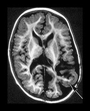 Fig. 9.30 (ei)