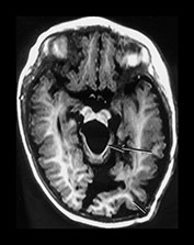 Fig. 9.30 (eii)