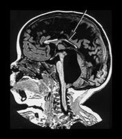Fig. 9.30 (eiii)