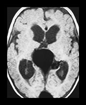 Fig. 12.4 (a) Fig. 12.4 (a)