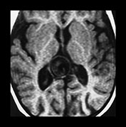 Fig. 12.4 (b) Fig. 12.4 (b)