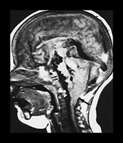 Fig. 12.5 Fig. 12.5
