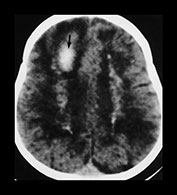 Fig. 12.6 (b) Fig. 12.6 (b)
