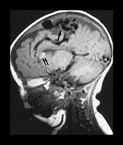 Fig. 12.7 (a) Fig. 12.7 (a)