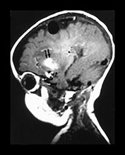 Fig. 12.7 (b) Fig. 12.7 (b)