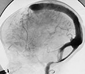 Fig. 12.7 (d) Fig. 12.7 (d)