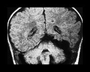 Fig. 12.9 (a) Fig. 12.9 (a)