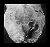 Fig. 12.9 (b) Fig. 12.9 (b)