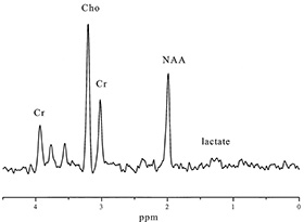 Fig. 17.1 (g)