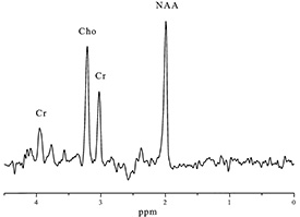 Fig. 17.1 (h)