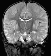 Fig. 17.3 (a)