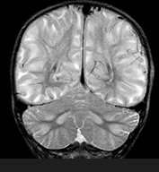 Fig. 17.3 (b)