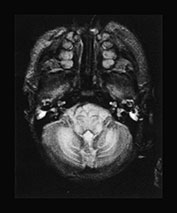 Fig. 17.4 (a)