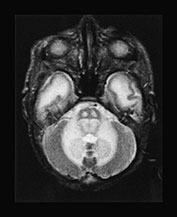Fig. 17.4 (b)