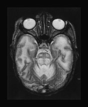 Fig. 17.4 (c)