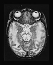 Fig. 17.4 (d)