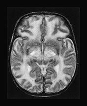 Fig. 17.4 (f)