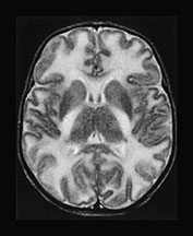 Fig. 17.4 (h)
