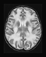 Fig. 17.4 (i)