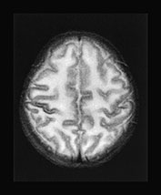 Fig. 17.4 (j)
