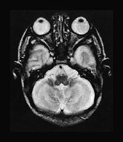 Fig. 17.6 (a)