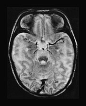 Fig. 17.6 (b)