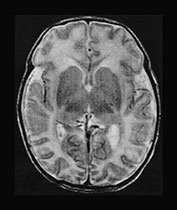 Fig. 17.6 (c)