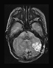 Fig. 17.7 (a)