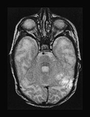 Fig. 17.7 (b)