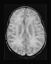 Fig. 17.7 (d)