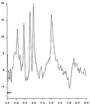 Fig. 17.8 (b)