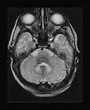 Fig. 17.9 (a)