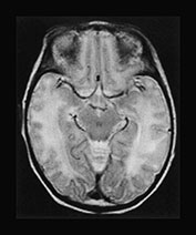Fig. 17.9 (b)