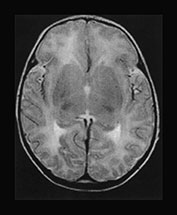 Fig. 17.9 (c)