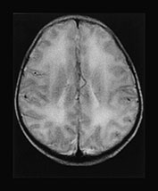 Fig. 17.9 (d)