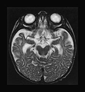 Fig. 17.9 (f)