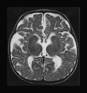 Fig. 17.9 (g)